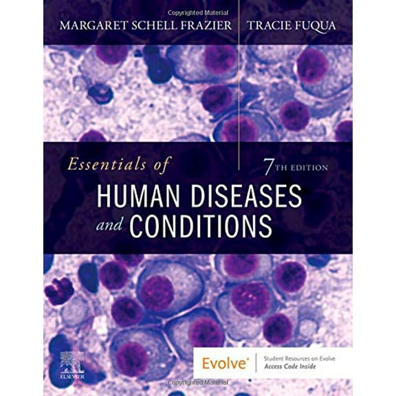 Pre-Owned Essentials of Human Diseases and Conditions (Paperback) 0323712673 9780323712675