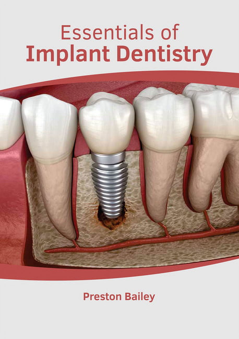 健康・医学 Implant Dentistry: Theory and Practice Implant Dentistry : A Practical Approach by Arun K. Garg