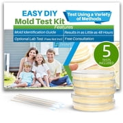 Air Mold Test Kit - Evviva Sciences - 5 Simple Mold Detection Tests - Optional Lab Analysis - Test HVAC System, Room Air, Home Surfaces - Includes Detailed Mold ID Guide