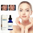 Exfoliating Vitamin C Facial With Concentrated 15 L Ascorbic For