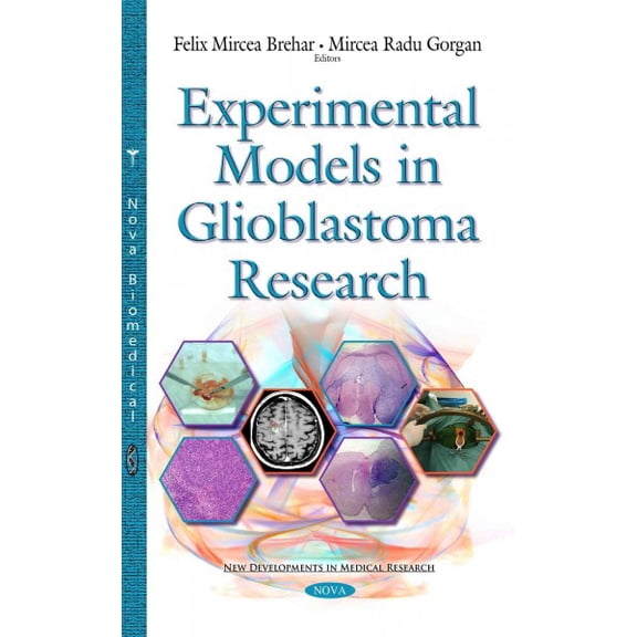 Experimental Models in Glioblastoma Research