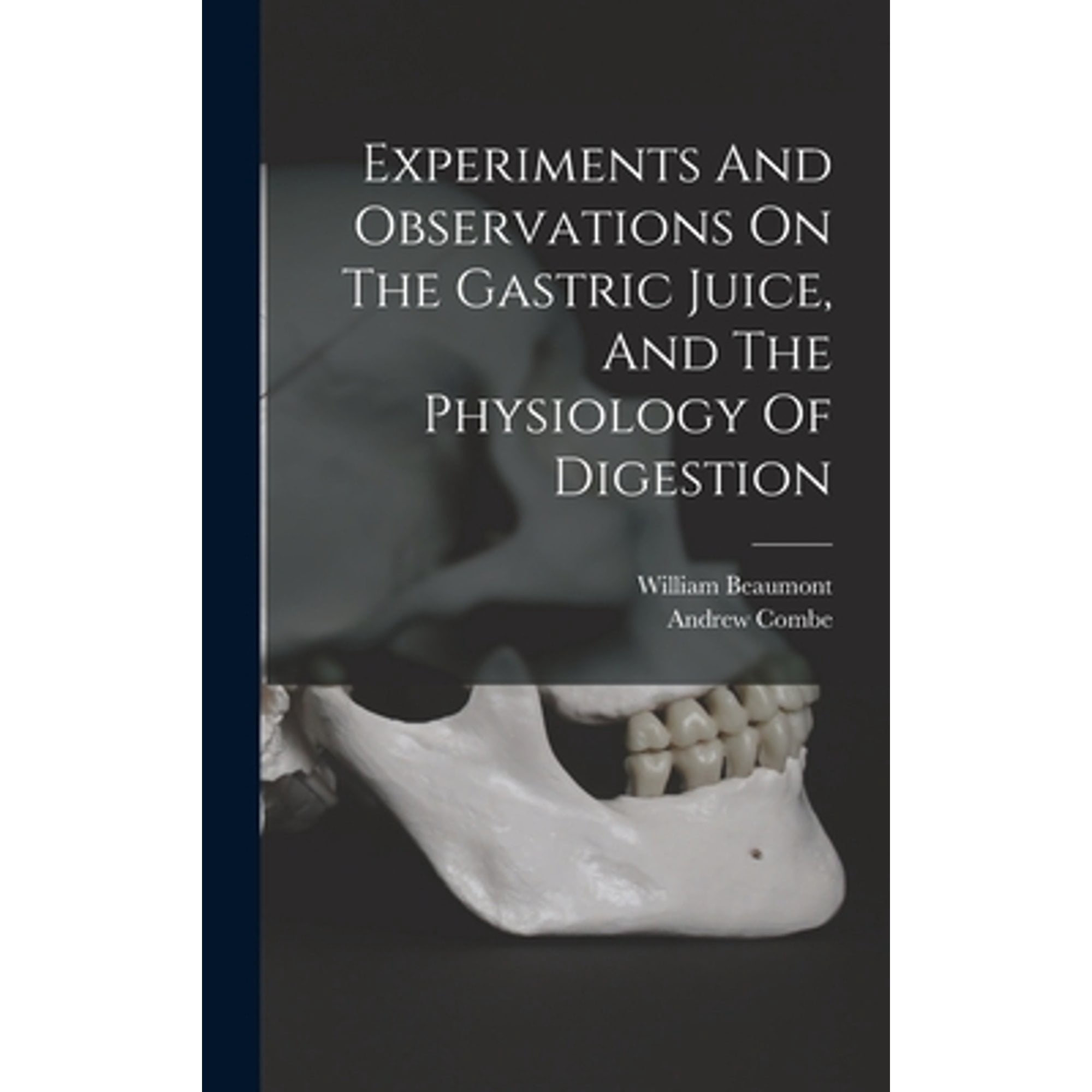 Experiments And Observations On The Gastric Juice, And The Physiology Of Digestion (Hardcover)