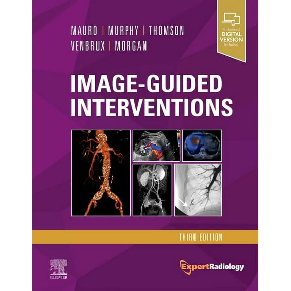 Expert Radiology Image-Guided Interventions: Expert Radiology Series, (Hardcover)