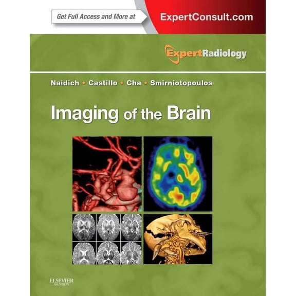 Expert Radiology: Imaging of the Brain: Expert Radiology Series (Hardcover)