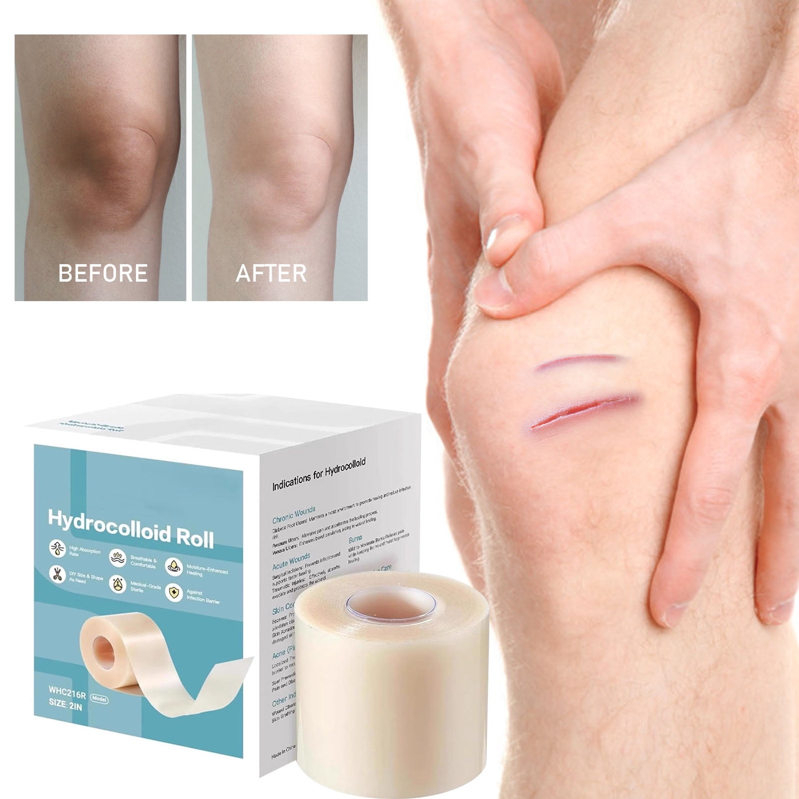 can you cut hydrocolloid dressing 5 Ways Die-Cut Hydrocolloid Adhesive Tapes Help Wound Care