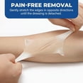 thumbnail image 1 of Extra Large Self-Adhesive Hydrocolloid Roll - 2in x 12ft Medical Grade Bandages for Wound Care, Acne, Blisters, Burns, Scrapes - Waterproof Cut-to-Size Patch for First Aid Kits, 1 of 4