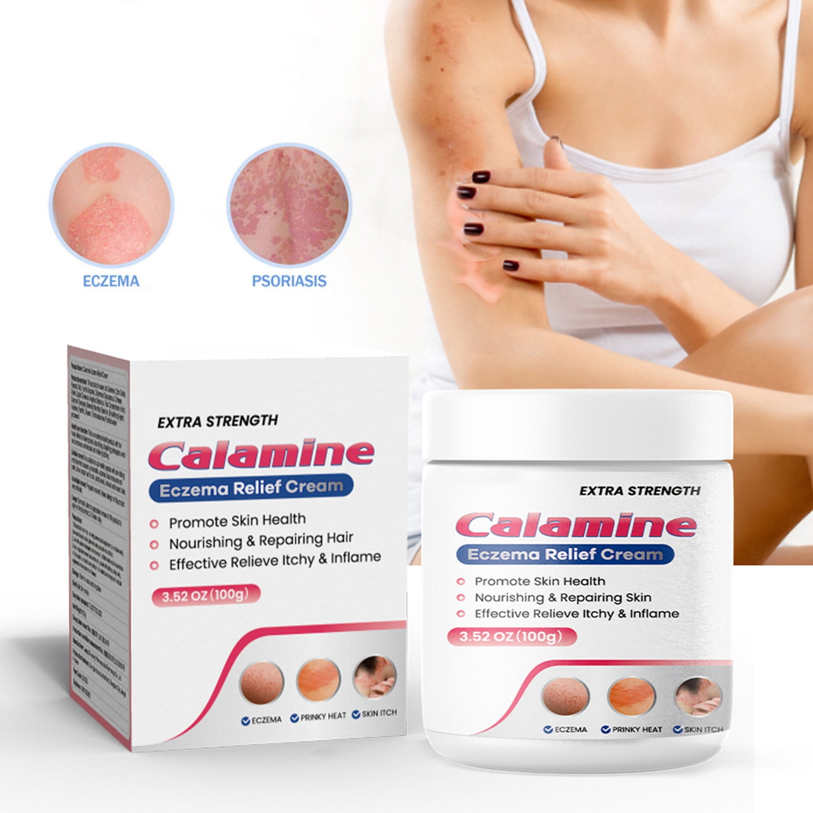 Calamine Eczema