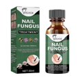 Extra Strength Nail Repair Fluid Toenail And Nail Solution Toenails And