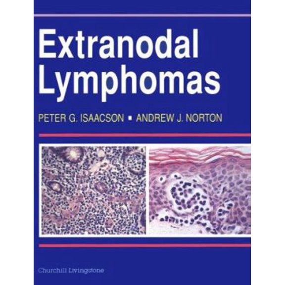 Pre-Owned Extranodal Lymphomas (Hardcover)