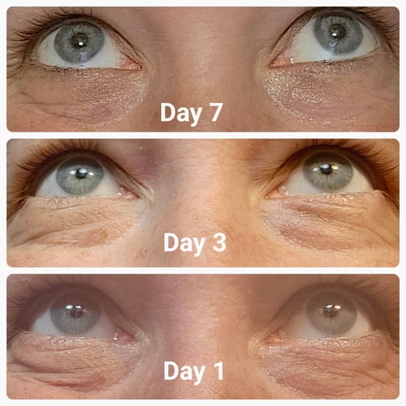 Eye 2 piece system 1/2 oz
