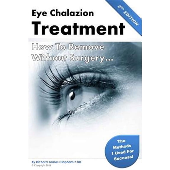 Eye Chalazion : How to Remove Without Surgery