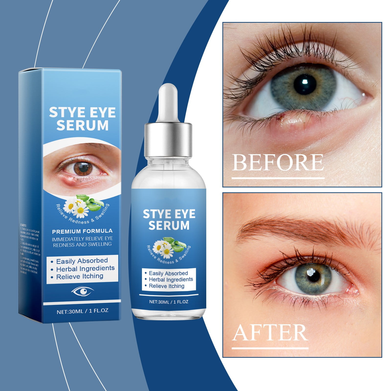 Eye Cream For Women, EyeTreatment, Eye Serum For Styes Chalazion And