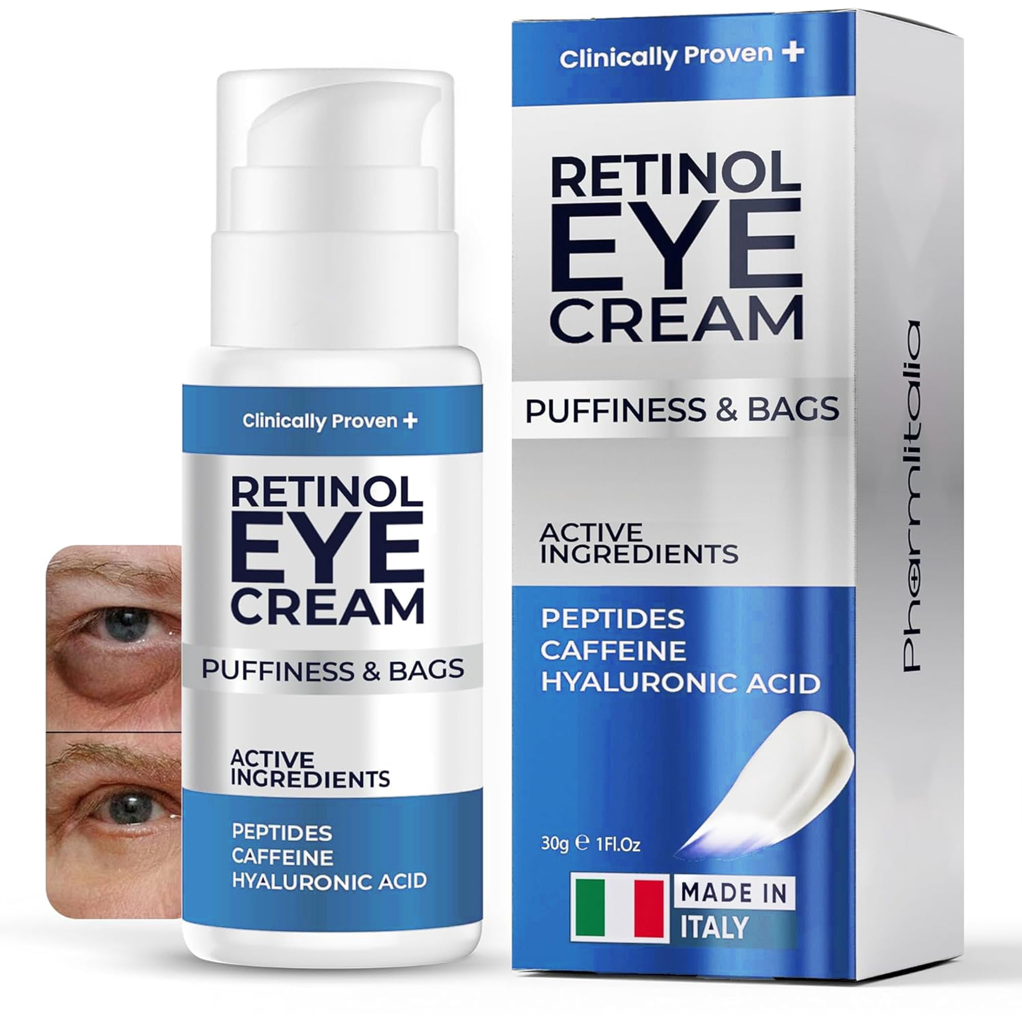 Under Eye Cream for Puffiness and Bags Under Eyes - Eye Bags Treatment for Men & Women - Anti Wrinkle Cream for Dark Circles, Baggy Eyes Treatment for Women with Retinol, Hyaluronic Acid & Caffeine