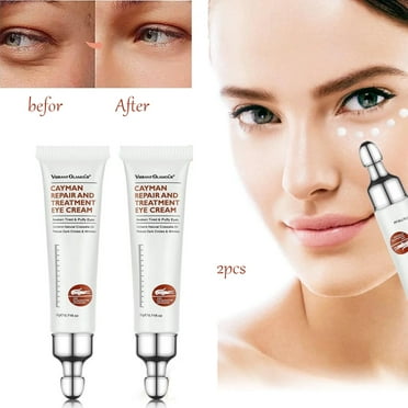 Eye Cream for Puffiness And Bags Under Eyes Instant，Firm That Delicate Skin Under Your Eyes ，Anti Aging Fine Lines，with Natrual Crocodile Oil