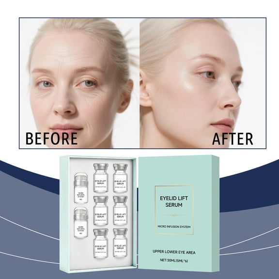 Eyelid Lift Serum with Retinol and Hyaluronic Acid for Upper & Lower Lids, Targets Drooping Eyelids & Bags, 30ml (2 Rollers, 6x5ml Bottles)