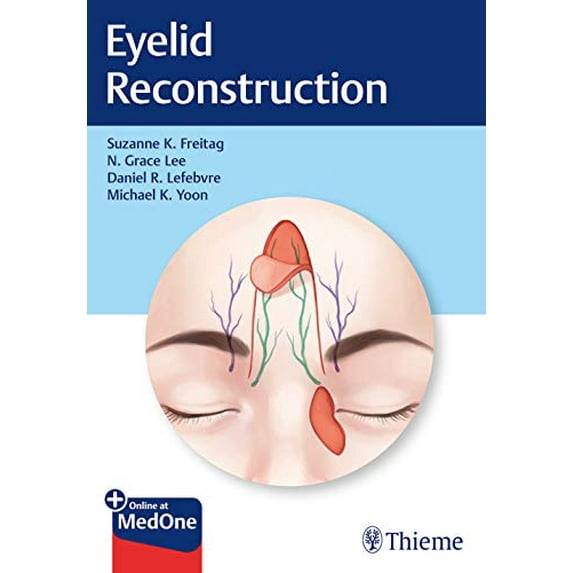 Pre-Owned Eyelid Reconstruction (Hardcover)