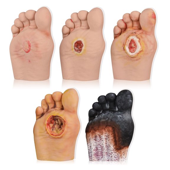 Eztrain 5 Pcs Diabetic Foot Care Model - Grade 1-5 Diabetic Foot Nursing Simulator Model, Human Foot Model for Anatomy, Physiology, Wound Care Demonstrations Tool