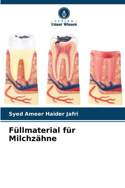 FÃ¼llmaterial fÃ¼r MilchzÃ¤hne, (Paperback)