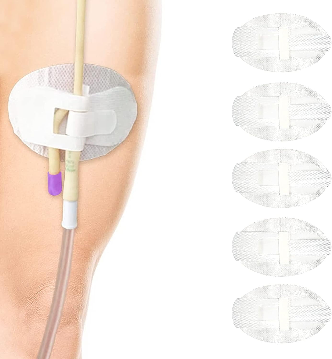 Numjaw 5Pcs Catheter Stabilization Device, Non-Woven Catheter Fixation Stickers, Catheter Legband Holder Sticker, Catheter Urinary Tube Holders