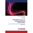 thumbnail image 1 of FDG PET/CT scans of Extrapulmonary Tuberculosis (Paperback), 1 of 1