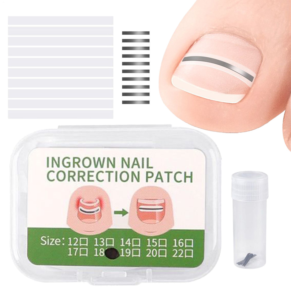 FEBUD Correction Patches for Nails 10 Piece Corrective Patches for Toe ...