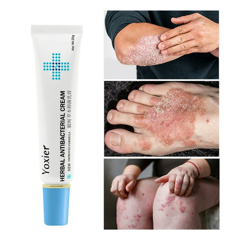 Ointment for skin rashes deals