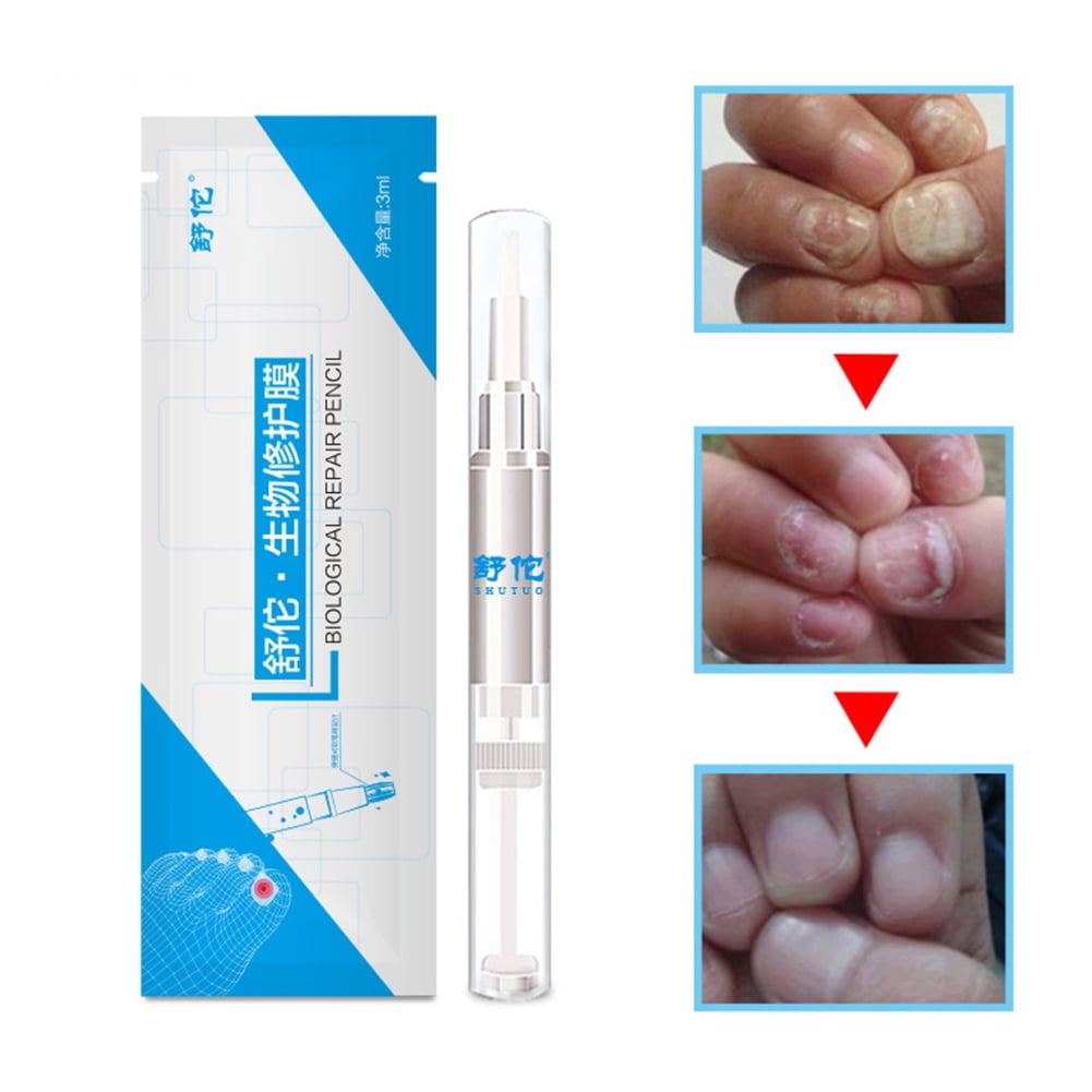 FLW 3ml Fungal Nail Treatment Pen Toe Anti Fungus Onychomycosis Paronychia Liquid f844ac8b 28cd 4908 896c 4b63337cce03.2c29040d61f5b59441d5291c086c6e8f