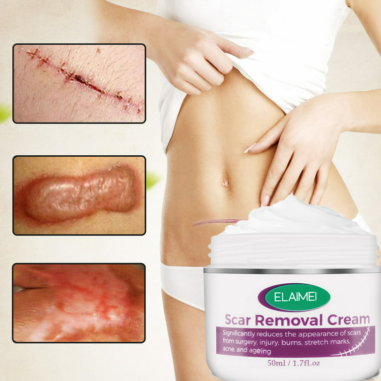 FLW 50ml Scar Cream Easy to Absorb Fade Scars Skin Care Scar Skin Stretch  Mark Treatment for Body Part