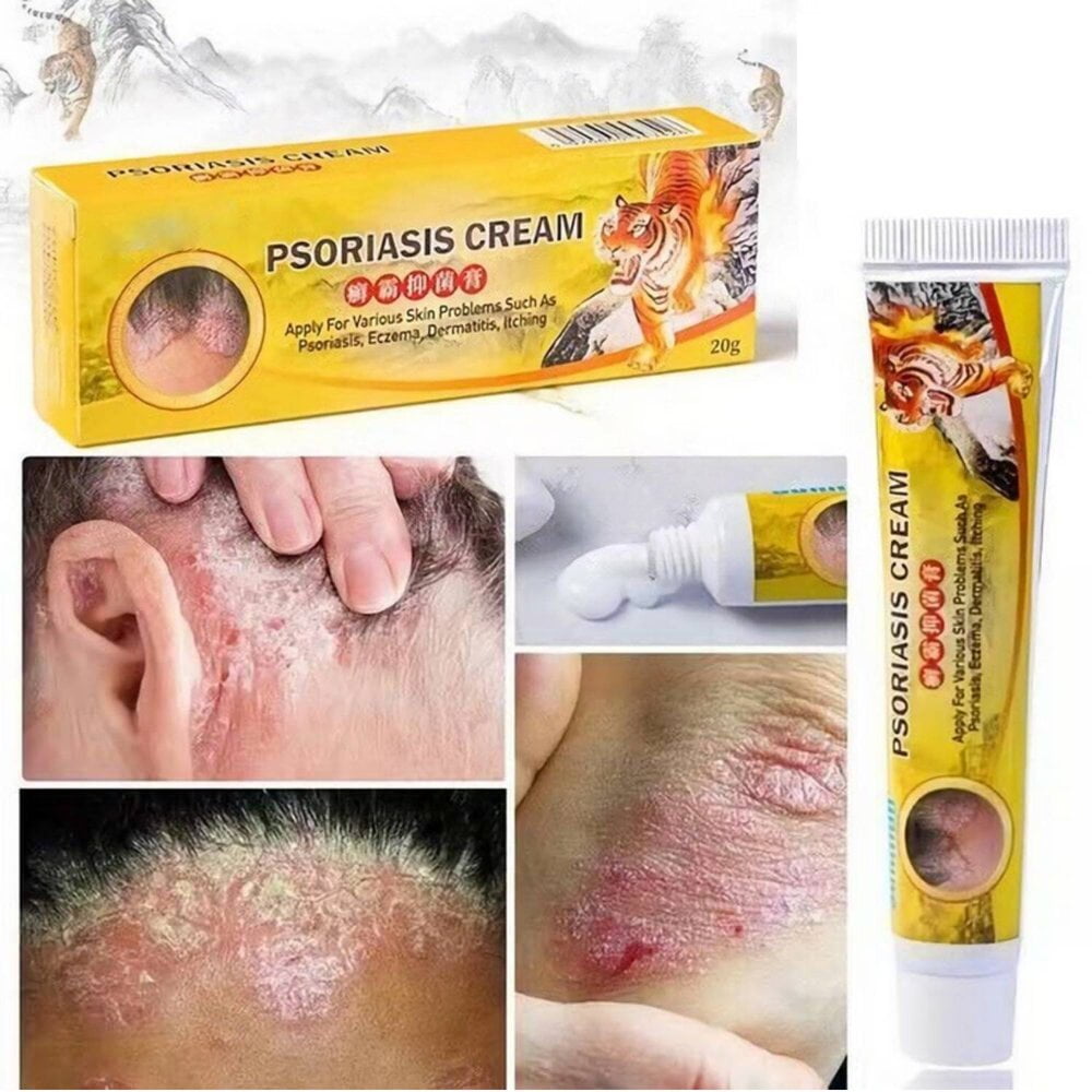 FNNMNNR Sumifun Psoriasis Ointment Skin Ointment Dermatitis Eczema