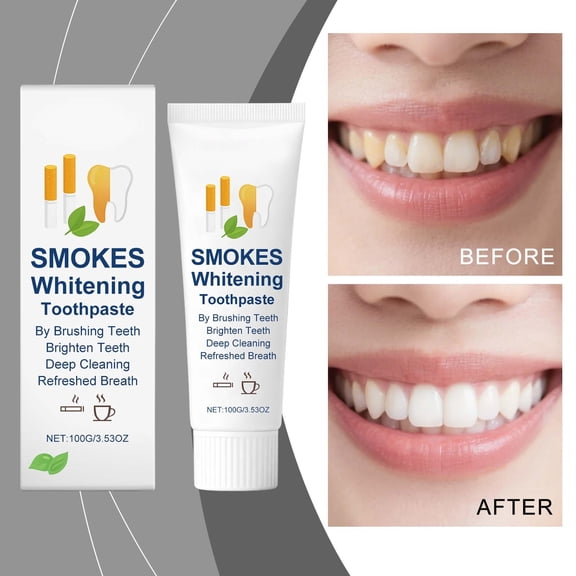 FSTDelivery All-Purpose Daily Teeth Care Toothpaste, Reduces Surface Stains Enhances Brightness Freshens Breath Gentle Enamel Care Supports Clean Oral Appearance