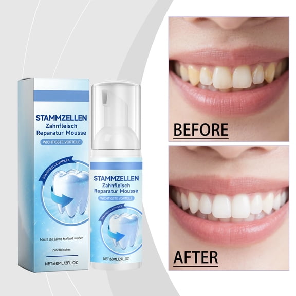 FSTDelivery Gentle Clean Teeth Cleaning Mousse, Rich Smooth Dense Foam Gentle Comprehensive Oral Care Cares for Teeth & Gums Supports Healthy Oral Condition Daily Use, 60ml