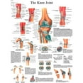 thumbnail image 1 of Fabrication B2137986 3B Anatomical Chart - Knee Joint, Sticky Back, 1 of 1