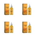 Transform Your Skin: The Facial Resurfacing Breakthrough - zdfu386