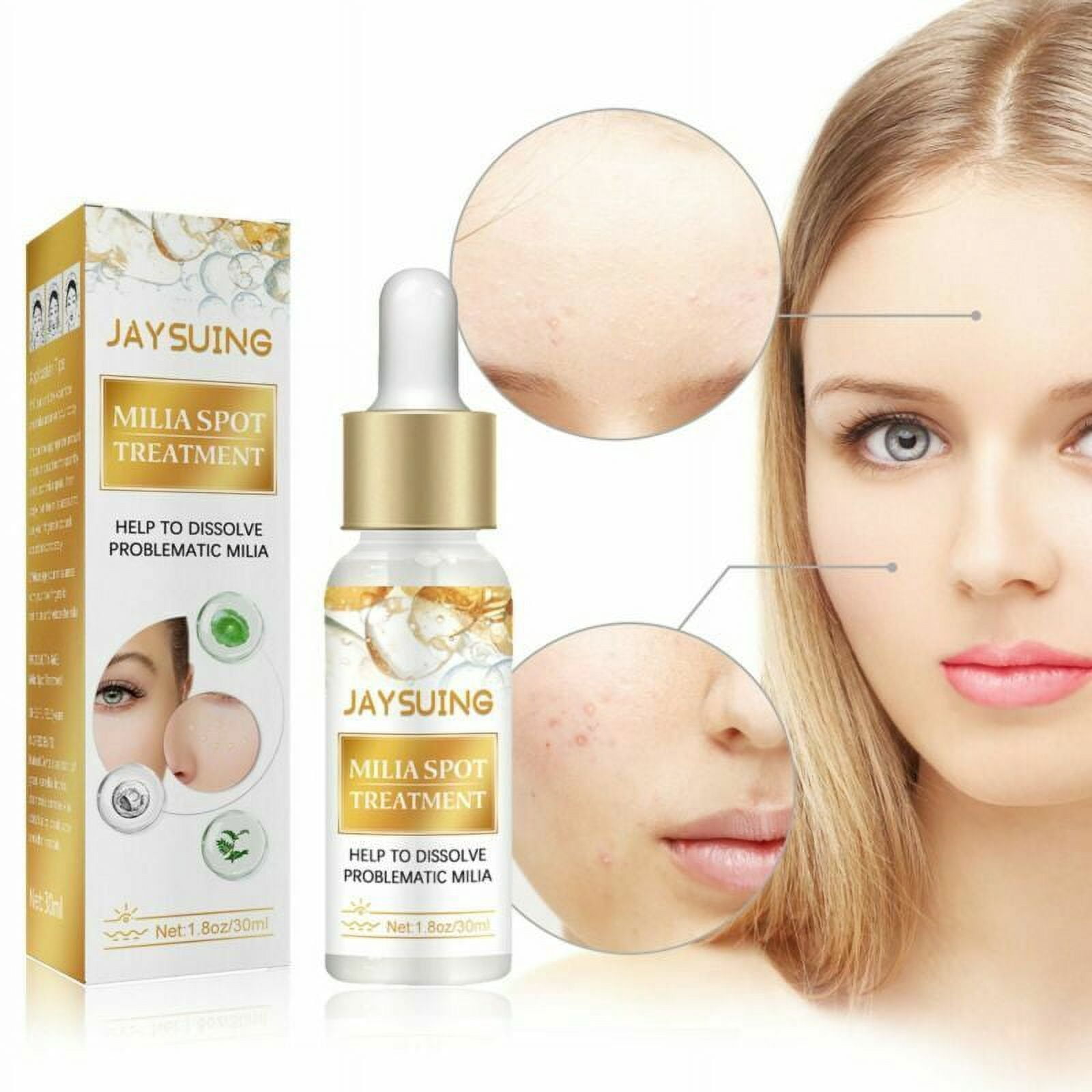 Facial Serum for Milia, Milia Remover Spot Treatment Helps Dissolve