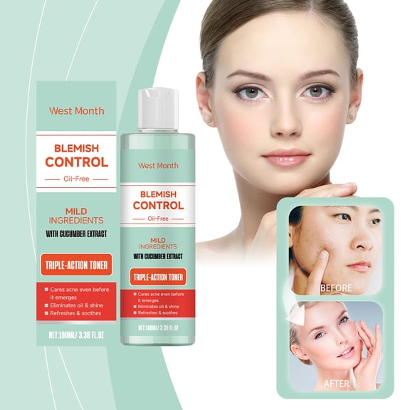 Facial toner, gentle ingredients, reducing acne and closed comedones, nourishing and repairing facial skin