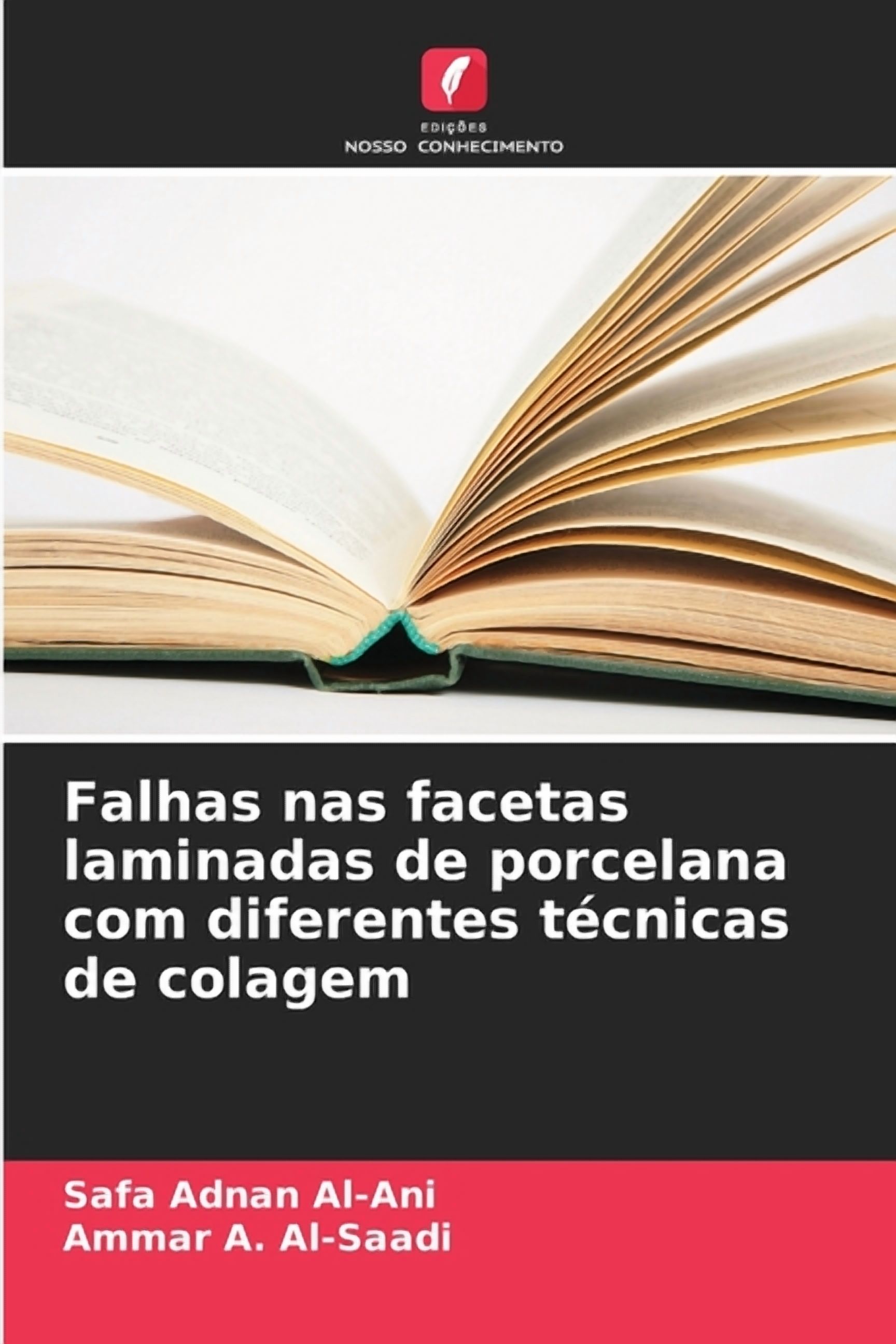 Falhas nas facetas laminadas de porcelana com diferentes tÃ©cnicas de colagem, (Paperback)