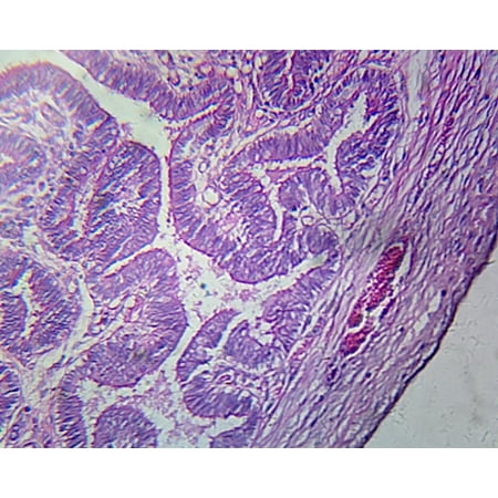 Fallopian Tube, Human; Showing General Oviduct Structure; Cross Section by Go Science Crazy