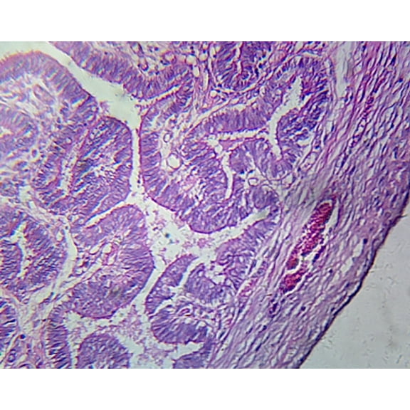 Fallopian Tube, Human; Showing General Oviduct Structure; Cross Section