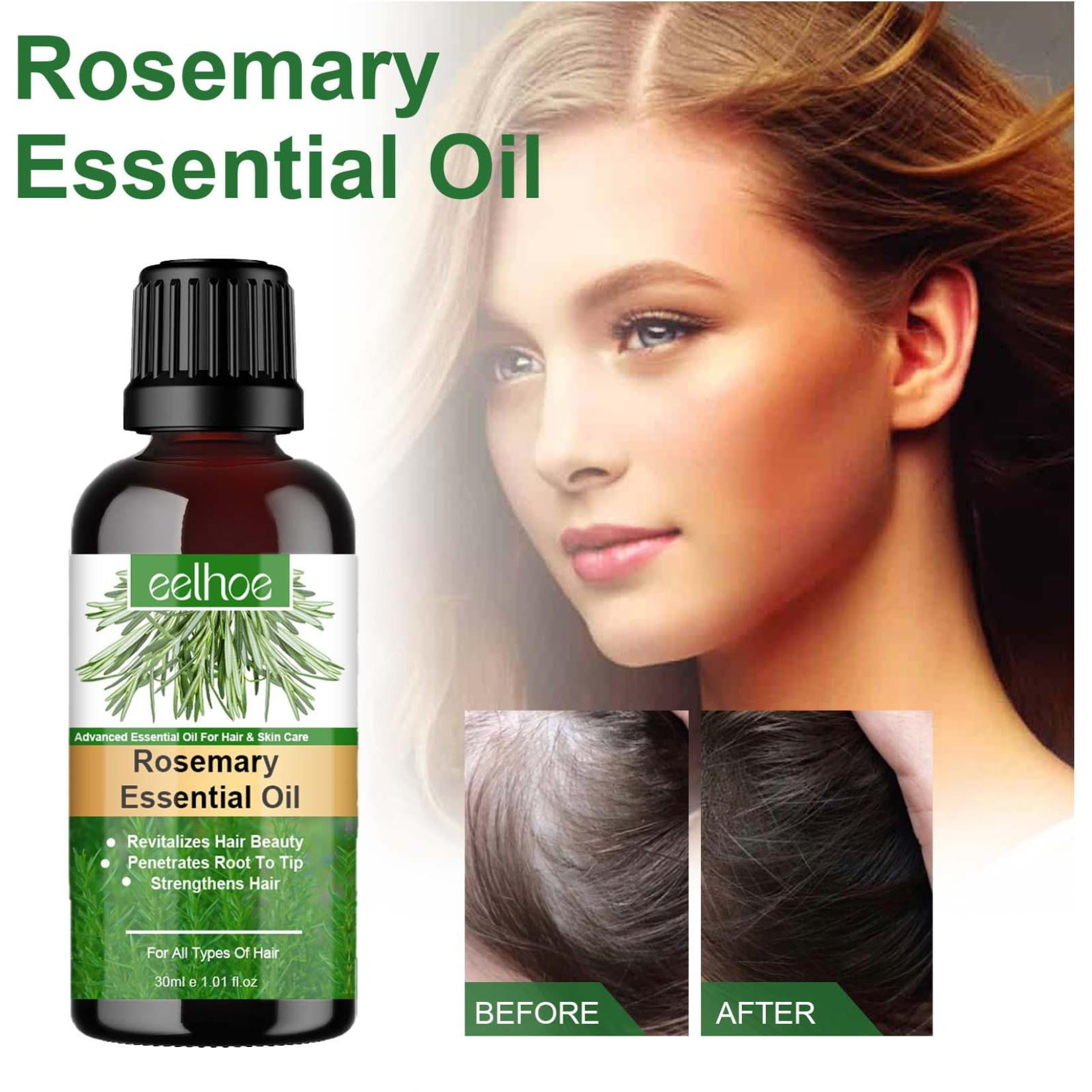 Fankiway Rosemary Essential Oil For Skin Care Hair And Scalp Hair ...