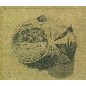 Farsot - Insects - Heavy Metal - CD