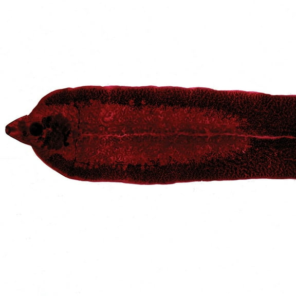 Fasciola Hepatica Slide, W.M.