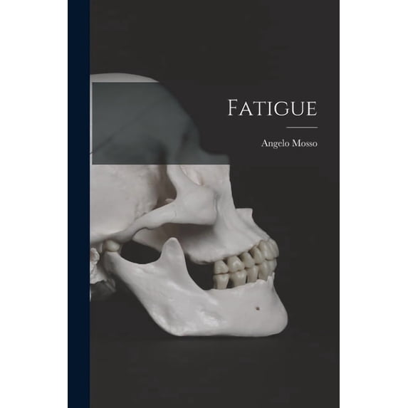 Fatigue, (Paperback)