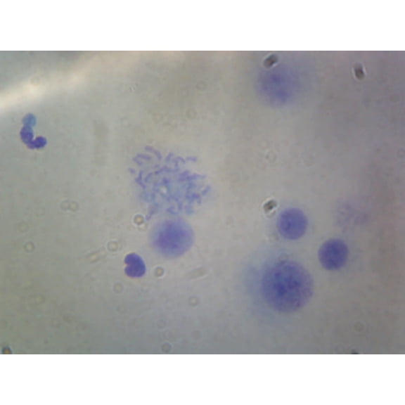Female Chromosomes, Human; Smear by Go Science Crazy
