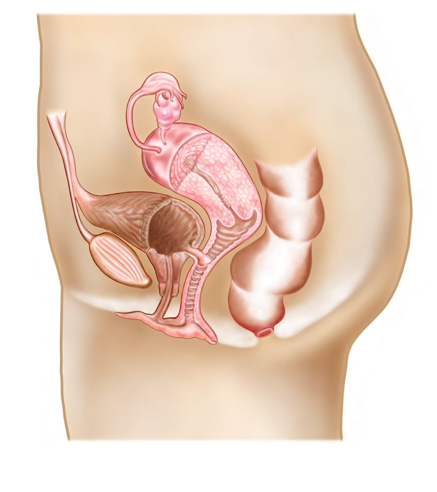Female vesicovaginal fistula cross section Canvas Art - Stocktrek Images (27 x 30)