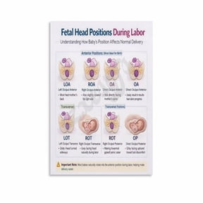 Fetal Head Positions During Labor Poster Childbirth Educational Chart Wall Art Canvas for Living Room Bedroom Decor