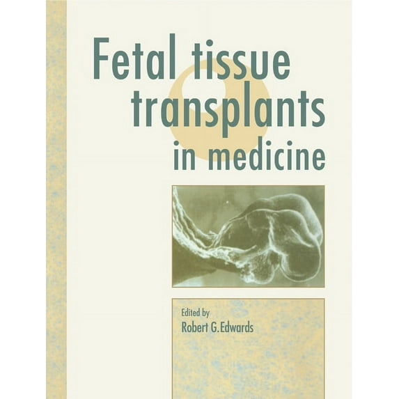 Fetal Tissue Transplants in Medicine, (Paperback)