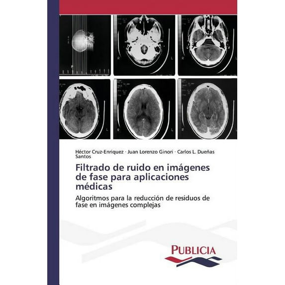 Filtrado de ruido en imágenes de fase para aplicaciones médicas (Paperback)