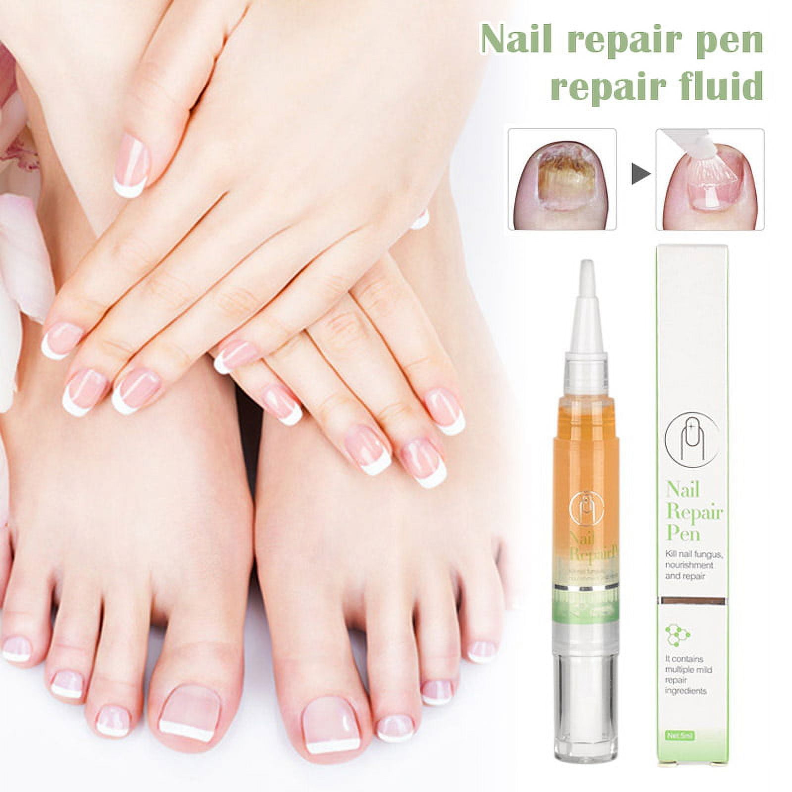 Fingernail Toenail Repair Pen Nail Repair Pen Protect from