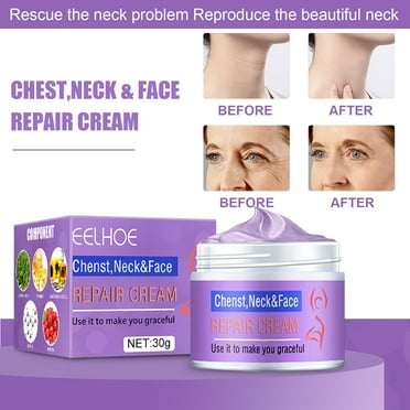 Firming Cream Face Tightening And Lifting Neck Tightener Wrinkle Cream - For Sagging Skin 30g