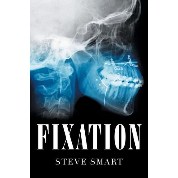 Fixation, (Paperback)